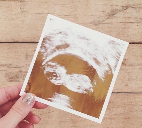 Lauren Conrad Pregnant: Vyhýbá se Kristin Cavallari po oznámení Baby News