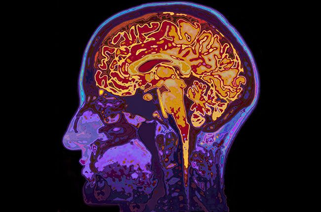 Anggur dan demensia: Studi berbenturan dengan manfaat kesehatan...