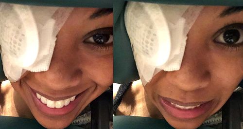 Els joves i els inquiets spoilers: cirurgia ocular d’urgència de Mishael Morgan: salva la visió amb ‘One Crazy Story’